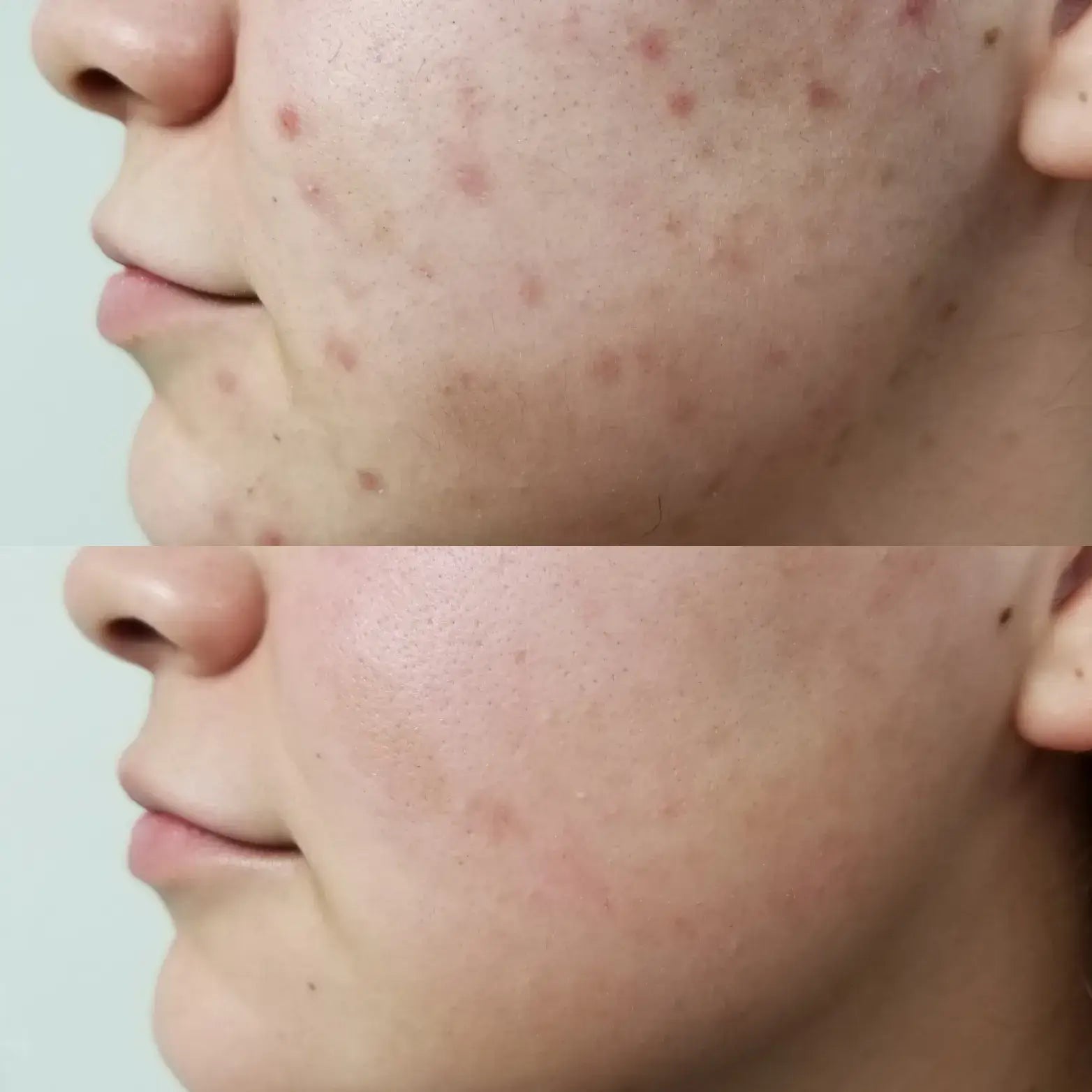 Dr. Melaxin™ Crema Dermatológica con Ácido Tranexámico y Niacinamida que Revitaliza tu Piel