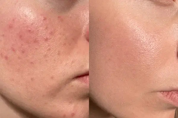 Dr. Melaxin™ Crema Dermatológica con Ácido Tranexámico y Niacinamida que Revitaliza tu Piel